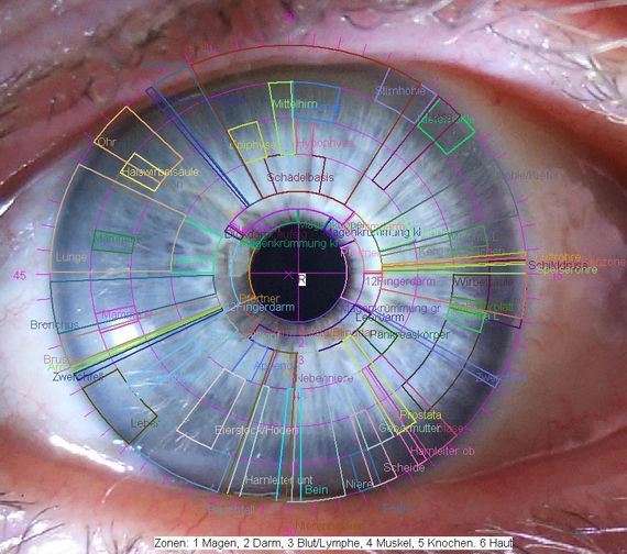 Irisdiagnostik