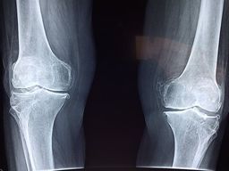 OSTEAMED - Dr. Markus Windhager in Marchtrenk